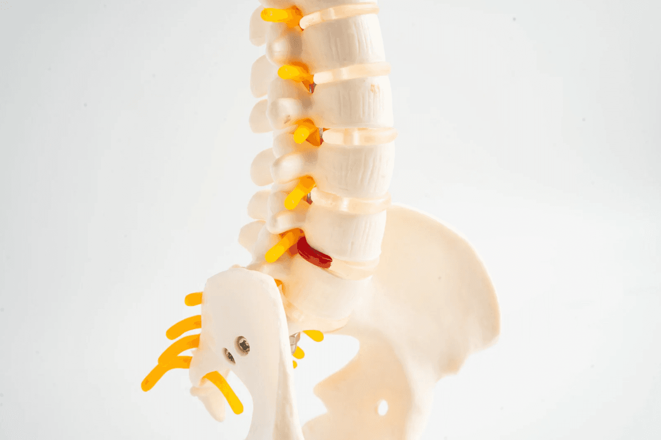 Herniated Disc vs. Strain After a Car Accident: When MRI Matters