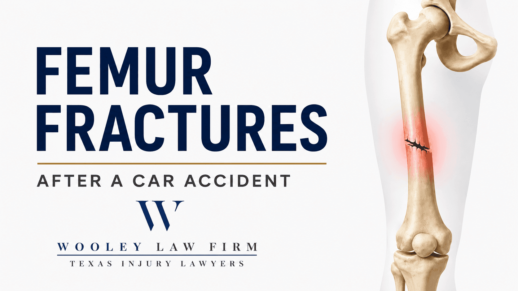 Femur Fractures After a Dallas Car Accident: What Victims Need to Know