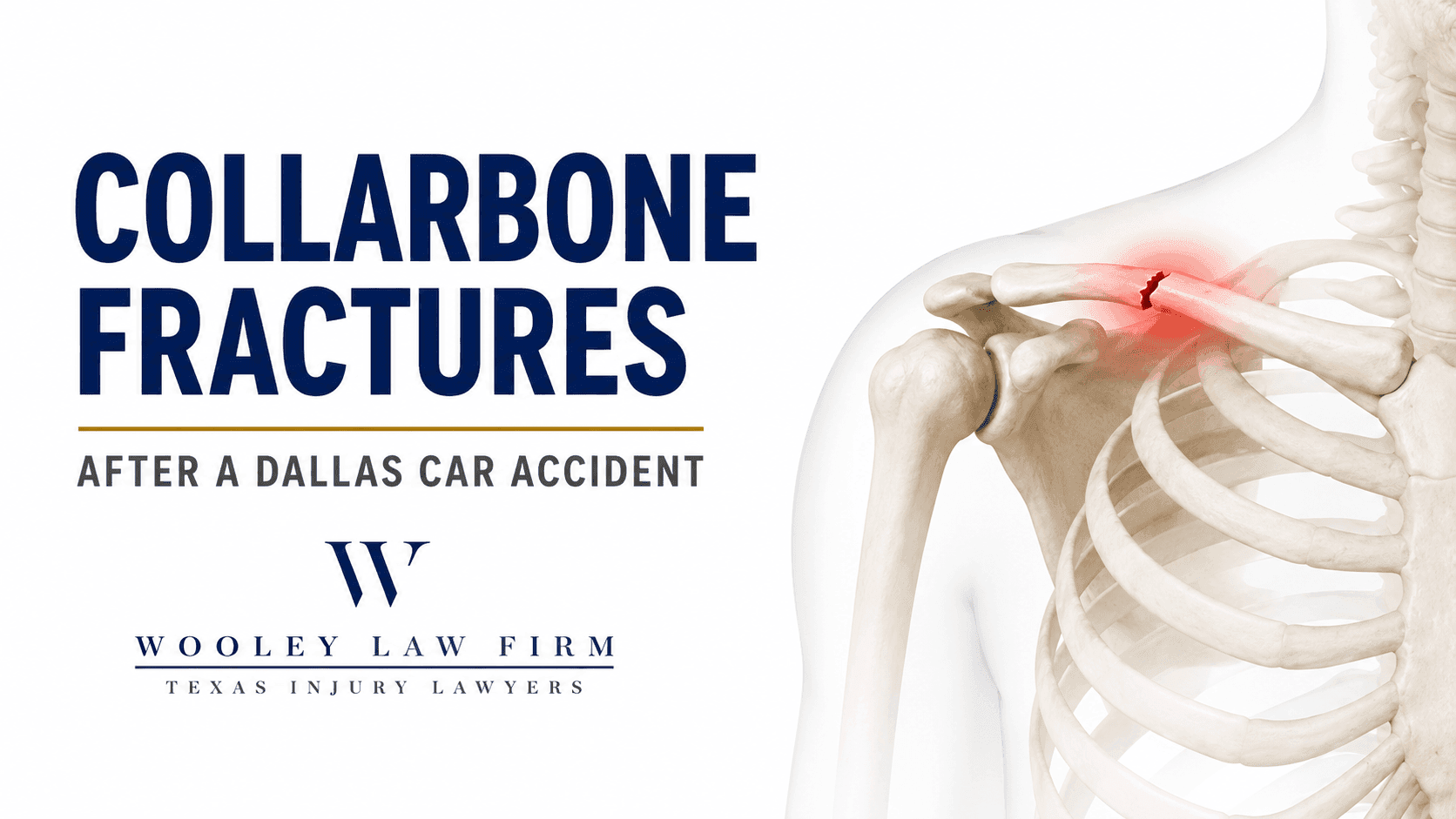 Collarbone Fractures After a Dallas Car Accident: What Victims Need to Know