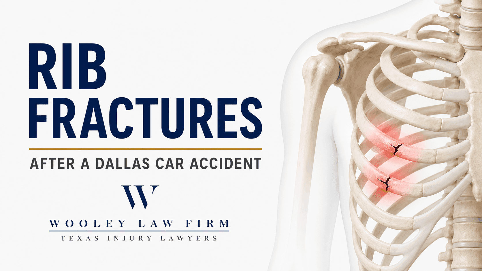 Rib Fractures After a Dallas Car Accident