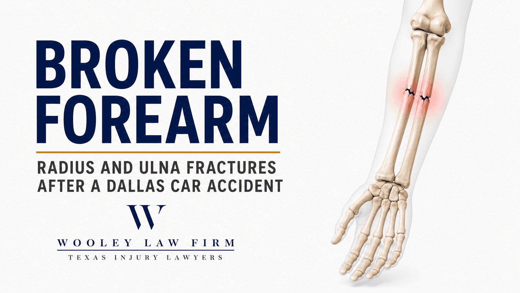 Broken Forearm After a Dallas Car Accident: Radius and Ulna Fractures