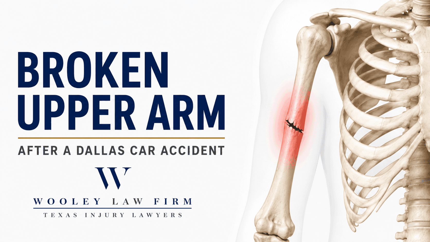 Broken Upper Arm (Humerus Fracture) After a Dallas Car Accident